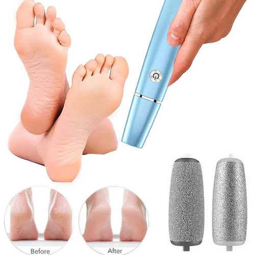 ⚡Electric Feet Callus Remover