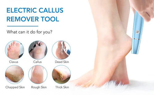 ⚡Electric Feet Callus Remover