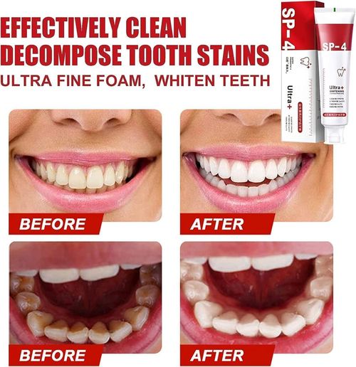 Ultra SP-4 Probiotic Whitening Toothpaste (2pcs,Red)