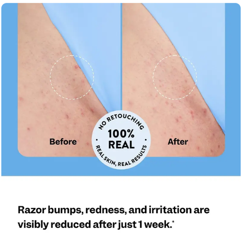 Hair removal soothing essence, moisturizing, gentle repair, refreshing and smoothing skin, hair removal roller care