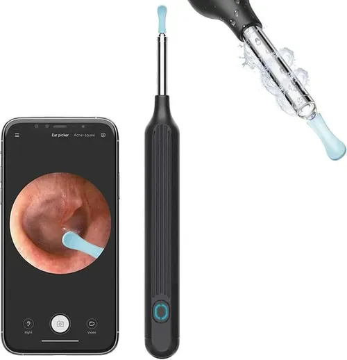 1080P Ear Wax Removal Camera