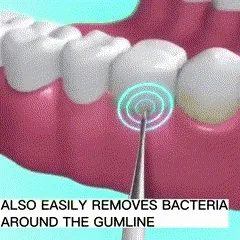 🦷✨Smile Brighter - Pro Ultrasonic Teeth Cleaner with Multi-Speed Control🦷✨