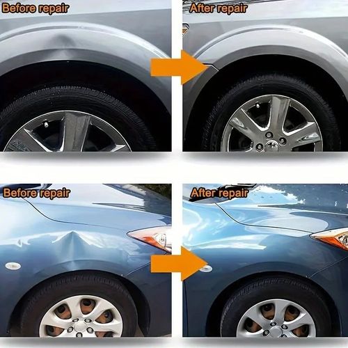 Paintless Car Dent Repair Kit