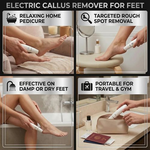 Callus Remover for Feet