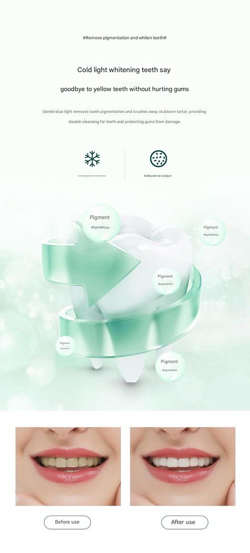 White U-Shaped Teeth Whitening Device - Electric Toothbrush with Fully Automatic Operation | Wireless Inductive Charging, Ultrasonic Adult Dental Brush for Lazy Users