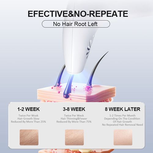 Multi-Laser Painless Hair Remover - White IPL Device w | 5-Level Safety & Full Body Kit | Permanent Results for Women at Home