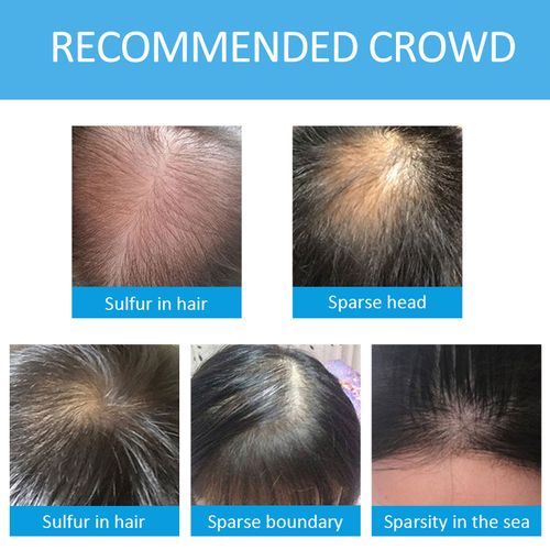 Effortless Root Cover Up - Instant Black Hair Fibers Spray | Powder | No-Mess Thickening for Thin Hair