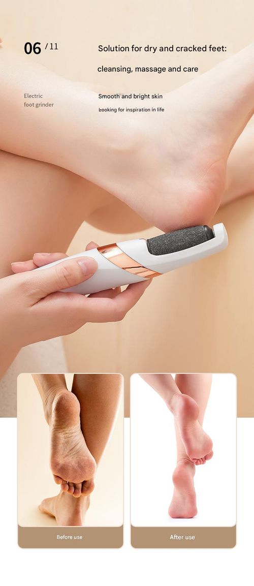 New Electric Foot Grinder - Automatic Callus Remover & Dead Skin Remover | Electric Pedicure Tool for Foot Care, White