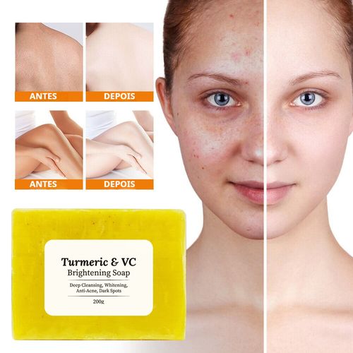 Sabonete de Cúrcuma e Vitamina C, Sabonete Facial de Limpeza Profunda para Remoção de Cicatrizes de Acne