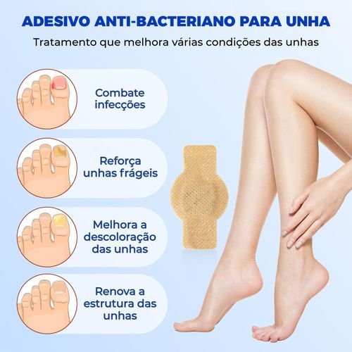 Patch de Tratamento de Micose – Reparo, Correção e Inibe Bactérias