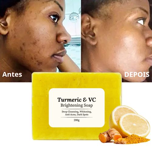 Sabonete de Cúrcuma e Vitamina C, Sabonete Facial de Limpeza Profunda para Remoção de Cicatrizes de Acne