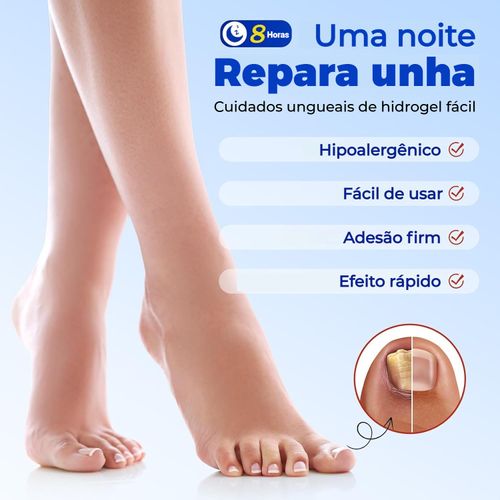 Patch de Tratamento de Micose – Reparo, Correção e Inibe Bactérias