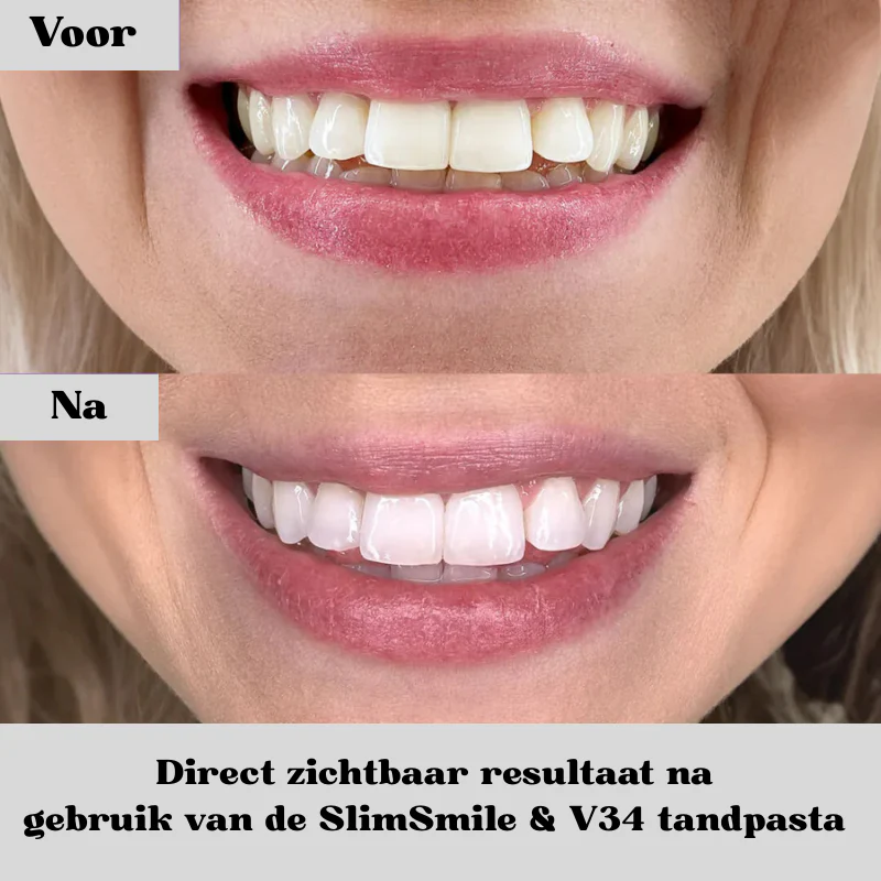 ⌛Last Day 50% OFF🔥U-shaped electric toothbrush, only 30 seconds a day, you can have a white smile