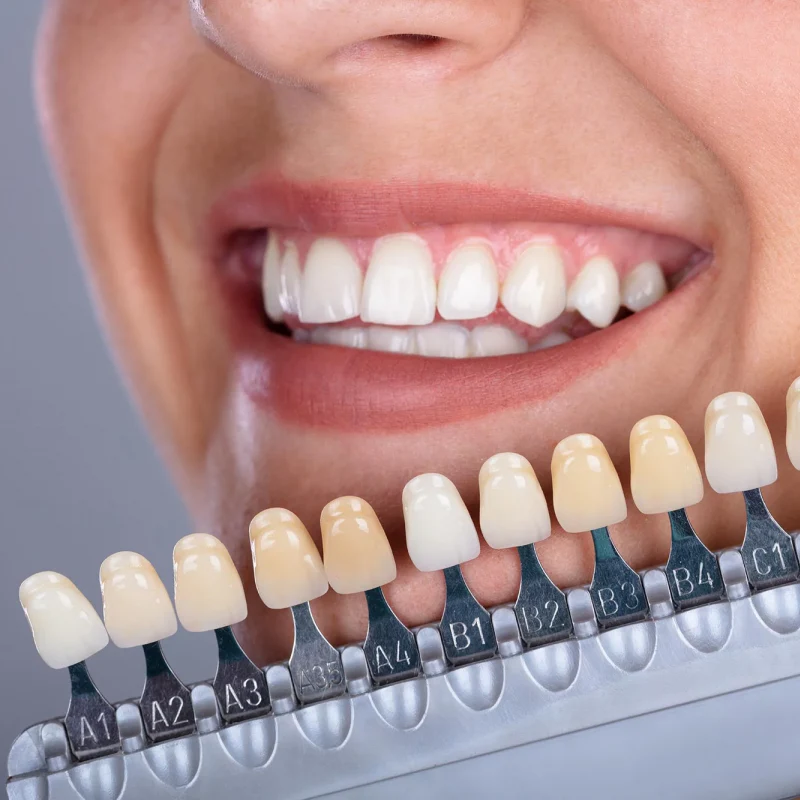 ⌛Last Day 50% OFF🔥U-shaped electric toothbrush, only 30 seconds a day, you can have a white smile