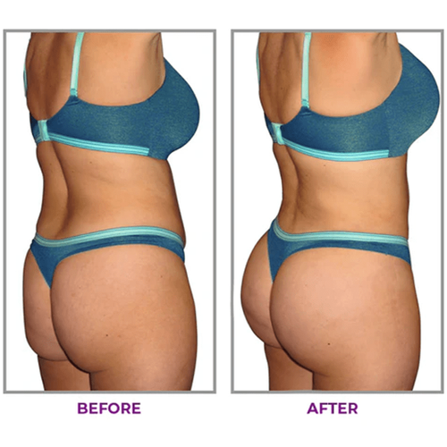 Buy1 Get 1 Free（2PCS）Hip Plump Capric Oil D01