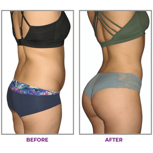 Buy1 Get 1 Free（2PCS）Hip Plump Capric Oil D01