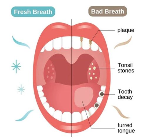 Toothpaste Mousse Foam, Calculus Removal, Teeth Whitening, Healing Mouth Ulcers, Eliminating Bad Breath, Preventing and Healing Caries, Tooth Regeneration