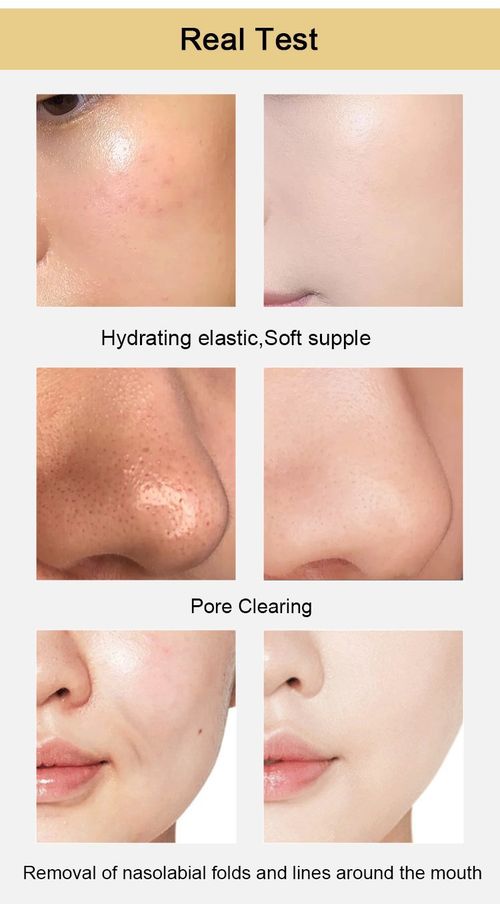 Gold Foil Peel-Off Mask