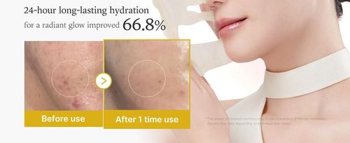Kojic Acid Turmeric Nicotinamide Night Mask