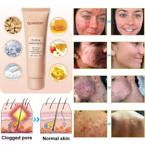 48% OFF PHANSTA Purifying Enzymes Exfoliating Gel