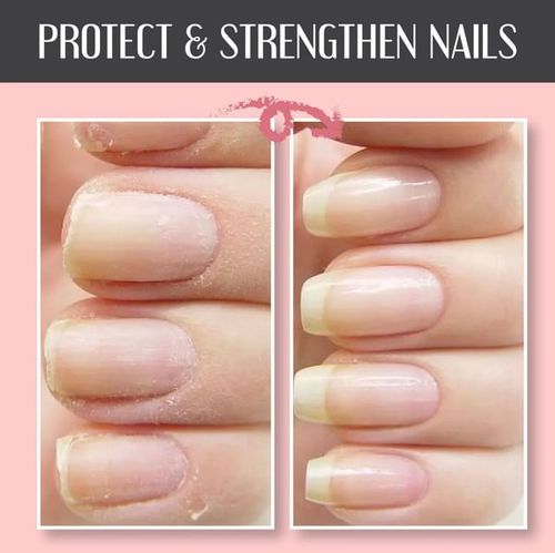 🔥Nail Repair Protection Gel