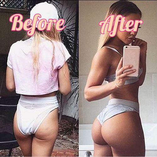 ip Massage Stimulation Lifting Buttock Muscle Hip Trainer