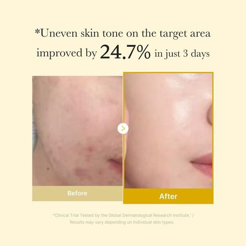Kojic Acid Turmeric Nicotinamide Night Mask
