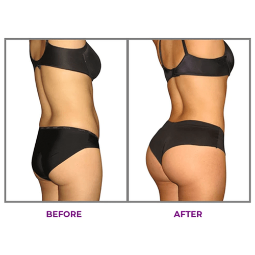 Buy1 Get 1 Free（2PCS）Hip Plump Capric Oil D01