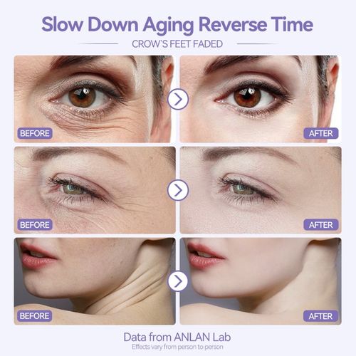 Facial Massager Multi-Polar Skin Firming V Shape Red Blue LED Light Therapy Sonic Vibration Anti-Aging Skin Care Device