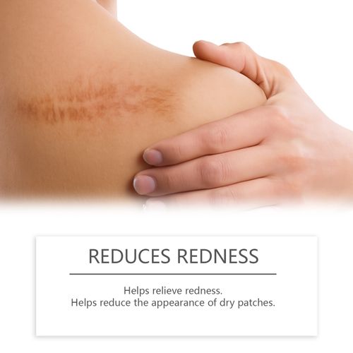 Skin Scar Hydrating Care Stick - Nourishing Facial & Body Scar Treatment for Smooth, Soft Skin Daily Care Cream