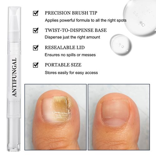 Nail Art Care Solution Nail Repair Pen Thickening Care for Nails