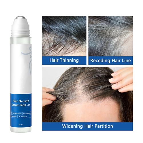 Hair ball essence gently care scalp hair growth nutrition hair root ball essence