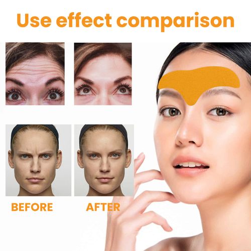 Gentle and smooth forehead patch, caring for fresh, comfortable, delicate and moisturizing forehead and facial skin patch