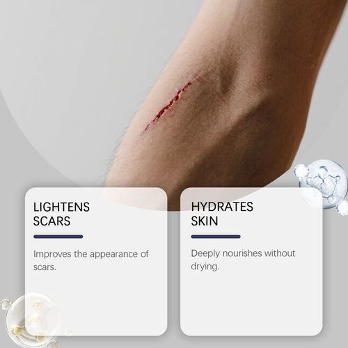 Skin Scar Hydrating Care Stick - Nourishing Facial & Body Scar Treatment for Smooth, Soft Skin Daily Care Cream