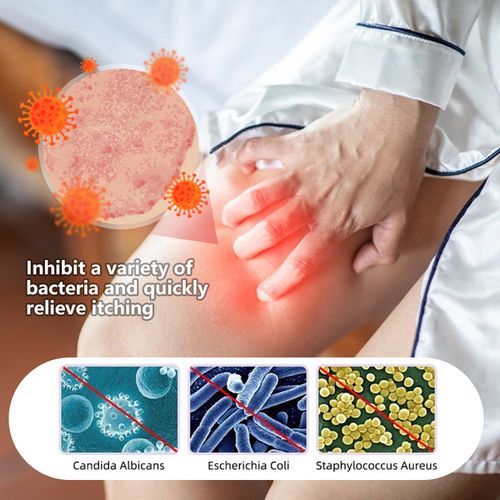 Private itching ointment Antipruritic and soothing herbal essence