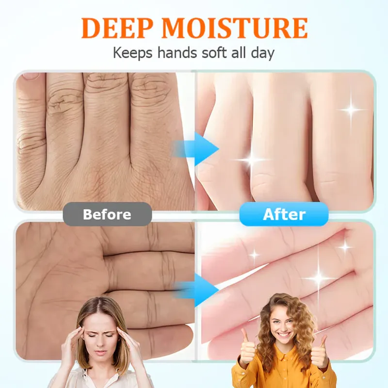 Turn Rough, Cracked Hands into Irresistibly Soft Radiance Every Day