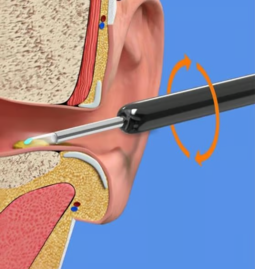 🔥🔥Wireless WIFI Visual Ear Pick
