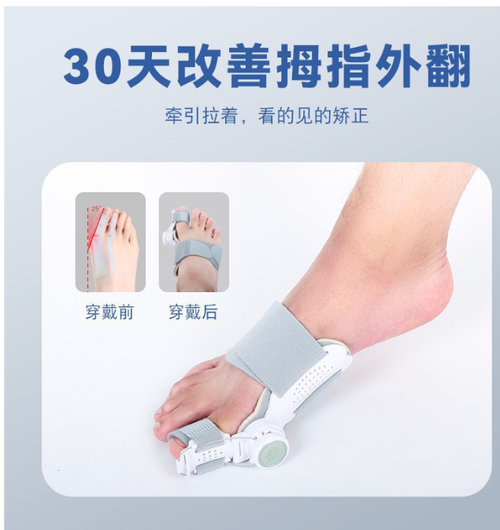 toe corrector