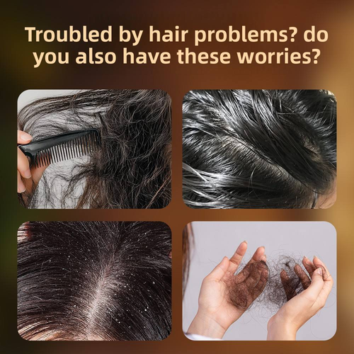 Vegan Usman Grass Cypress Leaf Shampoo Bar for Dry Itchy Scalp and Hair Growth