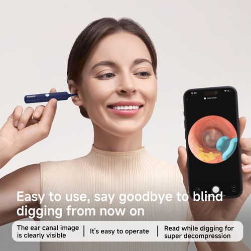 Smart Ear Cleaner for Kids – Illuminated Visual Ear Scoop with 360° Soft Silicone Tip, HD Endoscope for Ear Canal, 2-in-1 Cleaning & Care