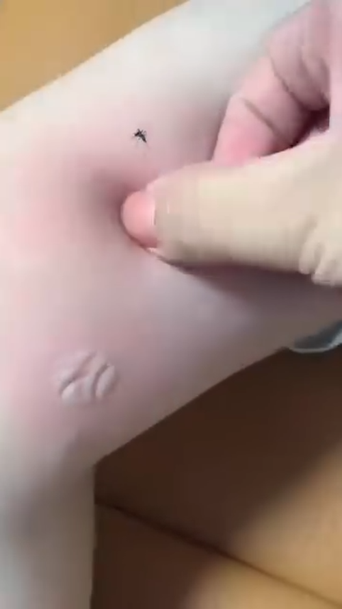 Mosquito Repellent Patch