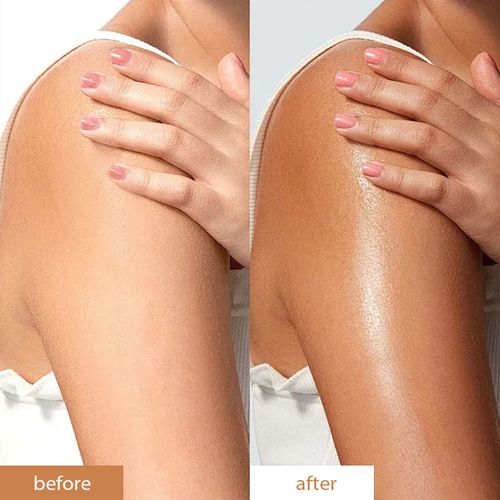 No-Tan Microneedle Patches