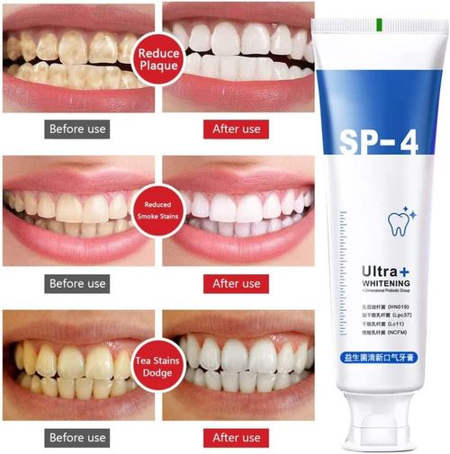 Yayashi SP-4 Probiotic Toothpaste - Brightening, Fresh Breath, Whitening, Natural Tooth Whitener