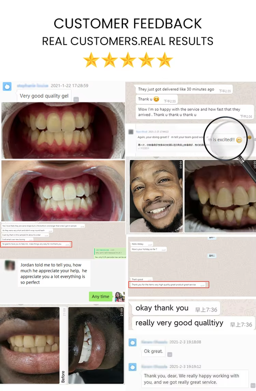 Home Wireless Customized Logo Teeth Whitening Led Kit