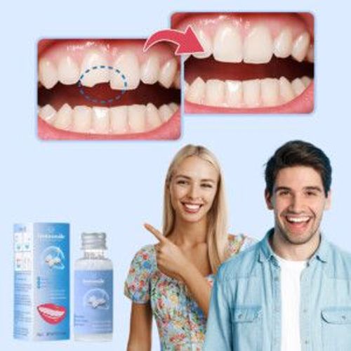 INSTASMILE – quick smile restoration for broken, missing or spaced teeth
