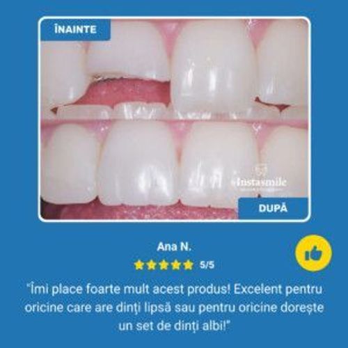 INSTASMILE – quick smile restoration for broken, missing or spaced teeth