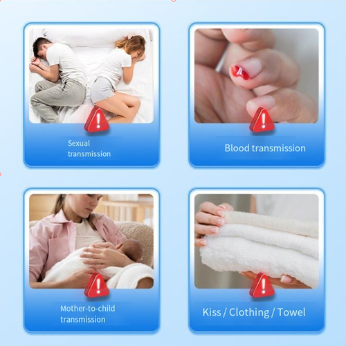 4-in-1 Blood Test Card: HIV, Syphilis, HBV & HCV Rapid Detection Kit。