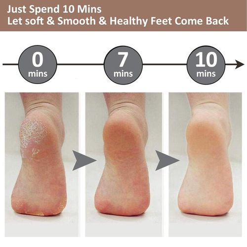 Rechargeable Electric Foot Callus Remover, Electric Foot Callus Remover Kit Foot File, Cordless Pedicure Machine, Foot Grinder, Portable Foot Files Cleaning Tool for Home and Travel, Winter Gift, Valentine's Day Gift