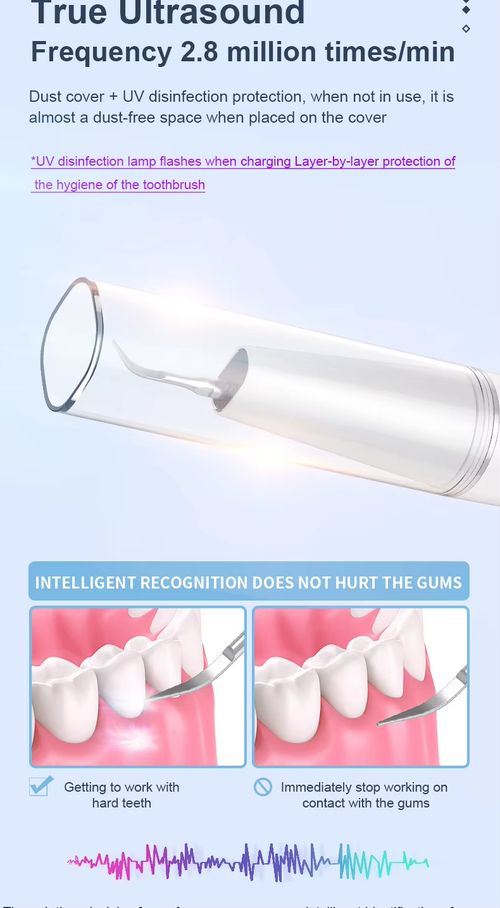 Removedor de placa de tártaro, removedor de pedras dentárias kit de limpeza de dentes