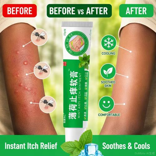 Mosquito bite balm 50pcs